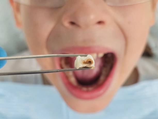 Best Urgent Care for Lost Fillings or Crowns in Fairway, KS